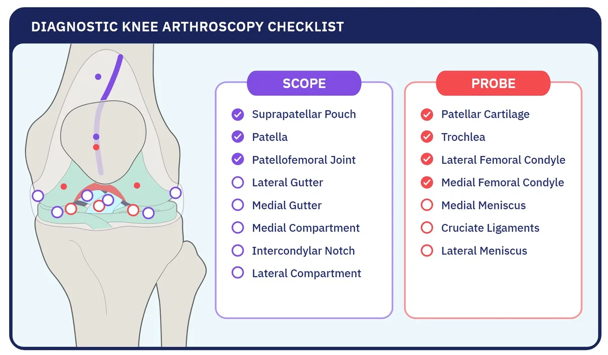 Diagnostic knee arthroscopy checklist pairing a knee illustration with Scope and Probe checklists